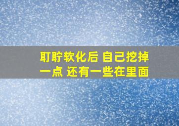 耵聍软化后 自己挖掉一点 还有一些在里面